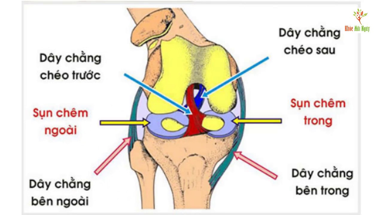 rách dây chằng gối (1)